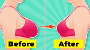 10 Effective Exercises To Reduce Boobs Naturally
